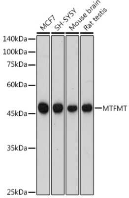 Western Blot: MTFMT AntibodyAzide and BSA Free [NBP3-16052]