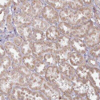 Immunohistochemistry: MTG1 Antibody [NBP2-46659]