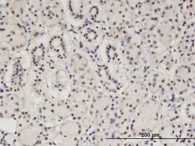 Immunohistochemistry-Paraffin: MTGR1 Antibody (2C10) [H00009139-M15]