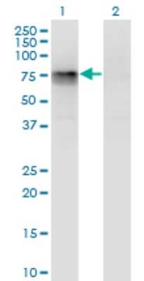 Western Blot: MTGR1 Antibody (3A2) [H00009139-M05]