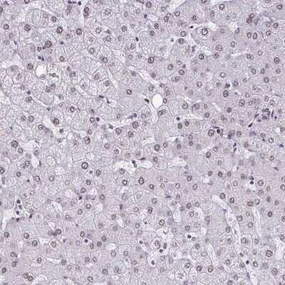 Immunohistochemistry-Paraffin: MTGR1 Antibody [NBP2-34136]