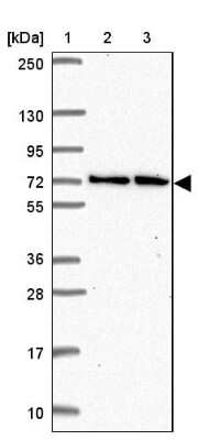 Western Blot: MTGR1 Antibody [NBP2-34136]