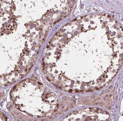 Immunohistochemistry-Paraffin: MTH1 Antibody [NBP2-54664]