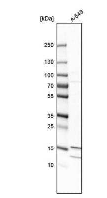 Western Blot: MTH1 Antibody [NBP2-54664]