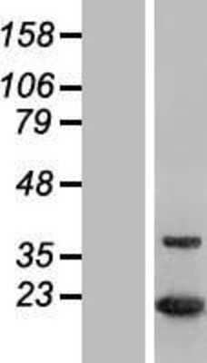 Western Blot: MTH1 Overexpression Lysate [NBP2-04633]