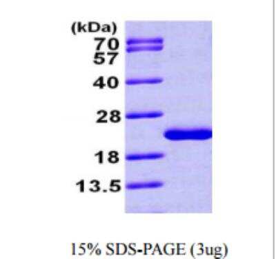 SDS-PAGE: Recombinant Human MTH1 His Protein [NBP1-49309]