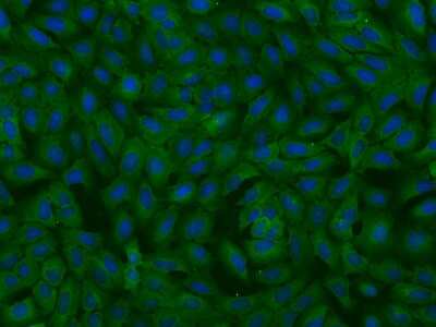 Immunocytochemistry/ Immunofluorescence: MTHFD1 Antibody [NBP2-97940]