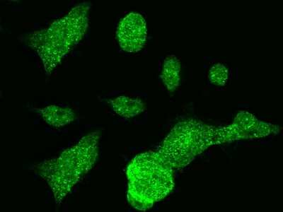 Immunocytochemistry/ Immunofluorescence: MTHFD1 Antibody [NBP2-99164]