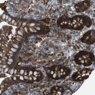 Immunohistochemistry-Paraffin: MTHFD1 Antibody [NBP1-82610]