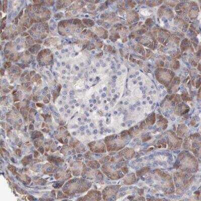 Immunohistochemistry-Paraffin: MTHFD1 Antibody [NBP1-82612]