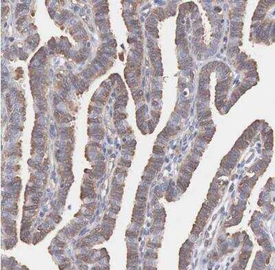 Immunohistochemistry-Paraffin: MTHFD1 Antibody [NBP1-82612]
