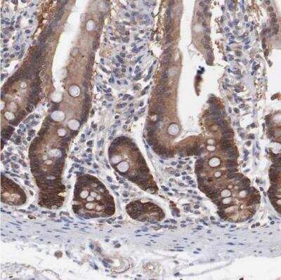 Immunohistochemistry-Paraffin: MTHFD1 Antibody [NBP1-82612]