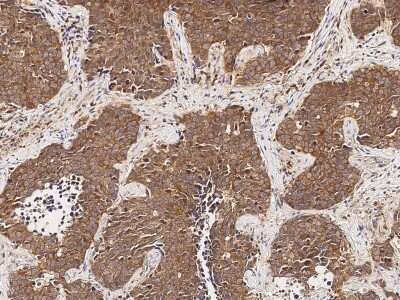 Immunohistochemistry-Paraffin: MTHFD1 Antibody [NBP2-99164]