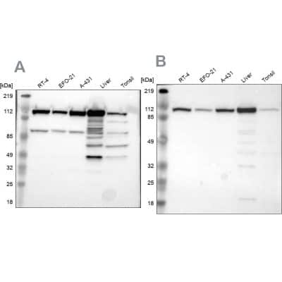 Western Blot: MTHFD1 Antibody [NBP1-82611]