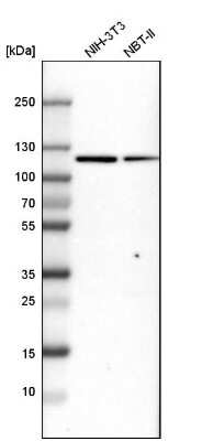 Western Blot: MTHFD1 Antibody [NBP1-82612]