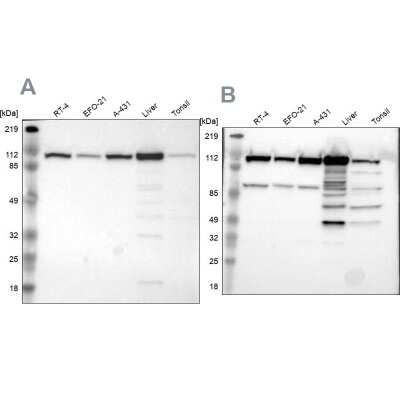 Western Blot: MTHFD1 Antibody [NBP1-82612]