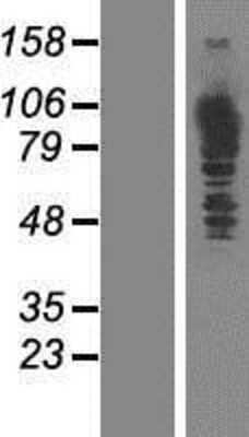 Western Blot: MTHFD1 Overexpression Lysate [NBP2-07686]