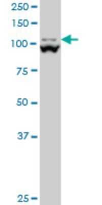 Western Blot: MTHFD1L Antibody (1E8) [H00025902-M01]