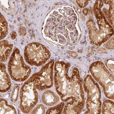 Immunohistochemistry: MTHFD1L Antibody [NBP2-37863]