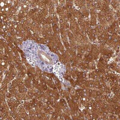 Immunohistochemistry: MTHFD1 Antibody [NBP2-46781]