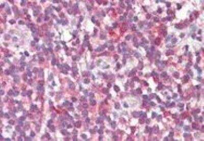 Immunohistochemistry-Paraffin: MTHFD1L Antibody [NBP1-78279]