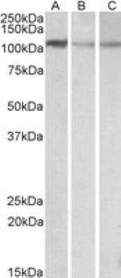 Western Blot: MTHFD1L Antibody [NBP1-78279]