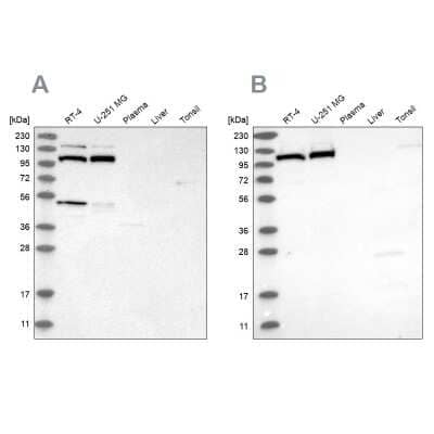 Western Blot: MTHFD1L Antibody [NBP2-37863]