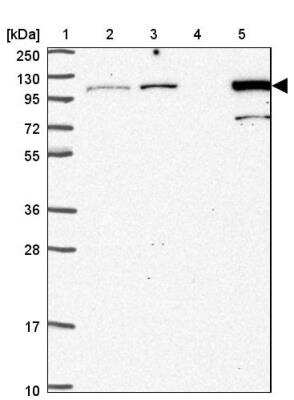 Western Blot: MTHFD1 Antibody [NBP2-46781]