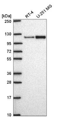 Western Blot: MTHFD1L Antibody [NBP2-57852]