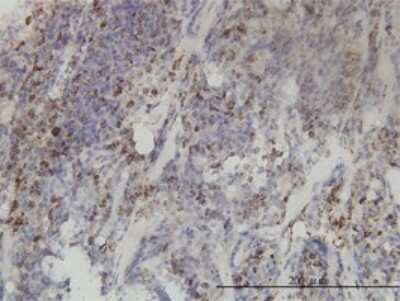 Immunohistochemistry-Paraffin: MTHFD2 Antibody (4G7-2G3) [H00010797-M01]
