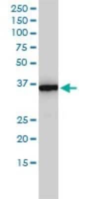 Western Blot: MTHFD2 Antibody (4G7-2G3) [H00010797-M01]