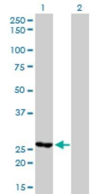 Western Blot: MTHFD2 Antibody (4G7-2G3) [H00010797-M01]