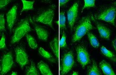 Immunocytochemistry/ Immunofluorescence: MTHFD2 Antibody [NBP1-33200]