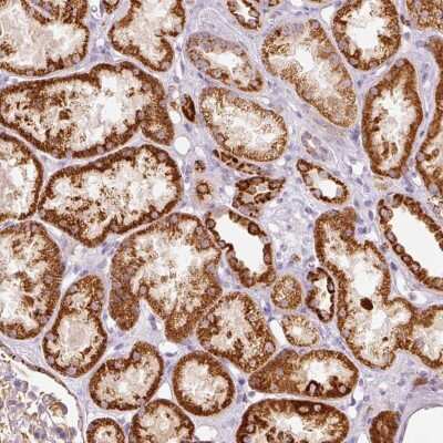 Immunohistochemistry: MTHFD2 Antibody [NBP2-33575]