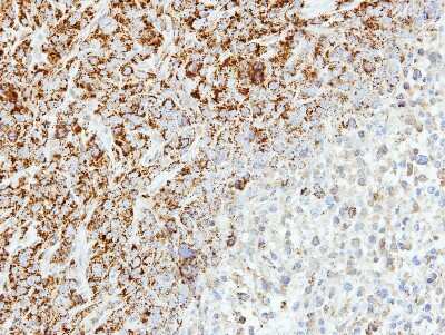 Immunohistochemistry-Paraffin: MTHFD2 Antibody [NBP1-33200]