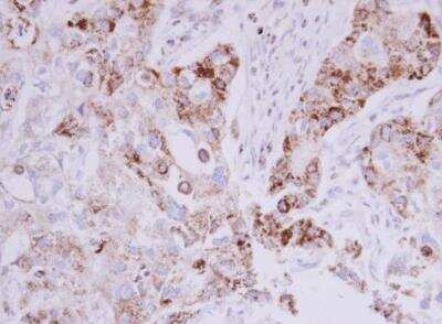 Immunohistochemistry-Paraffin: MTHFD2 Antibody [NBP1-33200]