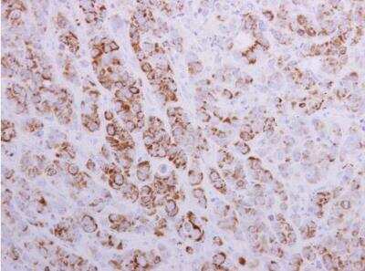 Immunohistochemistry-Paraffin: MTHFD2 Antibody [NBP1-33200]