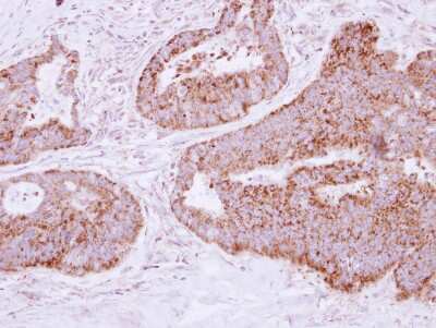 Immunohistochemistry-Paraffin: MTHFD2 Antibody [NBP2-19429]