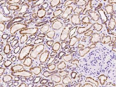 Immunohistochemistry-Paraffin: MTHFD2 Antibody [NBP2-97866]