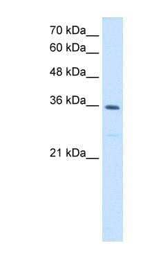 Western Blot: MTHFD2 Antibody [NBP1-54655]