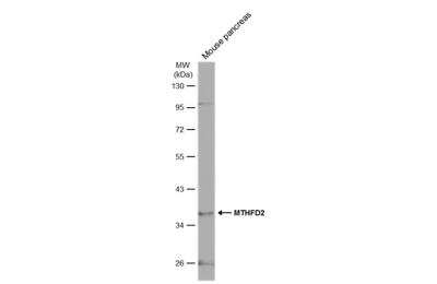 Western Blot: MTHFD2 Antibody [NBP2-19429]