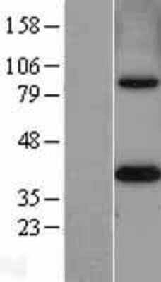 Western Blot: MTHFD2 Overexpression Lysate [NBL1-13363]