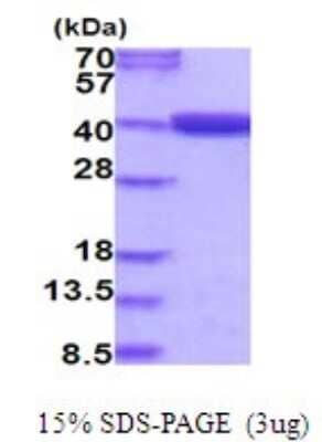 SDS-PAGE: Recombinant Human MTHFD2 His Protein [NBP2-51979]