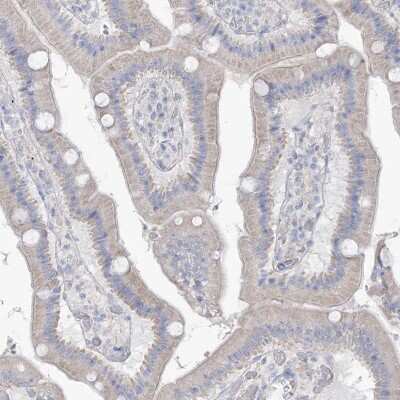 Immunohistochemistry-Paraffin: MTHFD2L Antibody [NBP1-82663]