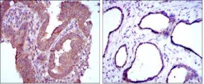 Immunohistochemistry-Paraffin: MTHFR Antibody (5D3) - BSA Free [NBP2-37607]