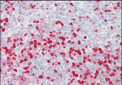 Immunohistochemistry-Paraffin: MTHFR Antibody [NBP1-45222]