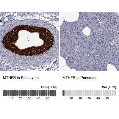 Immunohistochemistry-Paraffin: MTHFR Antibody [NBP3-17040]