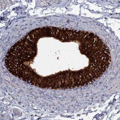 Immunohistochemistry-Paraffin: MTHFR Antibody [NBP3-17040]