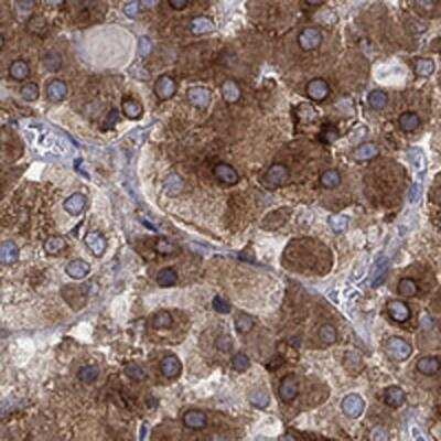 Immunohistochemistry-Paraffin: MTHFR Antibody [NBP3-17040]