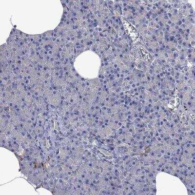 Immunohistochemistry-Paraffin: MTHFR Antibody [NBP3-17040]
